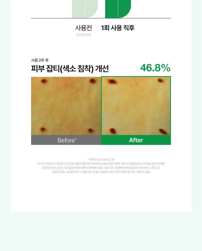 [NEW/리뉴얼] 아누아 어성초 77 B3 징크 트러블 세럼 30ml 더블 기획 상세페이지 24
